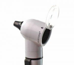 Riester e-scope Vakuum/Xenon 2,5V/2,7V Otoskop mit Batteriegriff – Detailansicht Diagnostikkopf