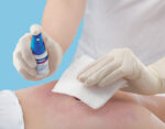 Essity / BSN Cutimed PROTECT Spray Medizinischer Hautschutz, Anwendungsbeispiel