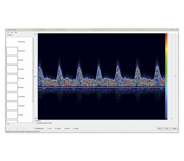 Huntleigh DR5 dopplex® Reporter Software