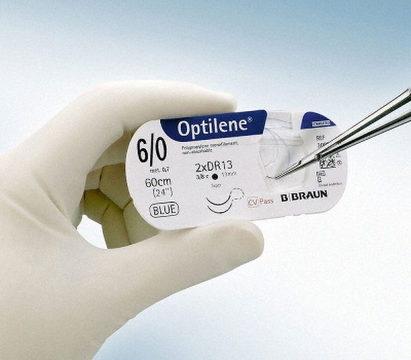B.Braun Optilene Nahtmaterial, nicht resorbierbar (Anwendungsbeispiel)