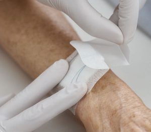 BSN medical Leukoplast Leukomed skin sensitive Wundverband (Anwendungsbeispiel)