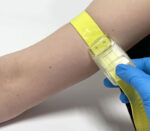 Kimetec CBC Nucos Silikon-Venenstauer mit Einrastverschluss (Anwendungsbeispiel)