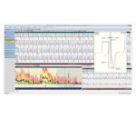 Amedtec EP830 Langzeit-EKG – Bildschirmansicht Fortlaufendes EKG mit HF-Trend und vergrößertem Einzelschlag
