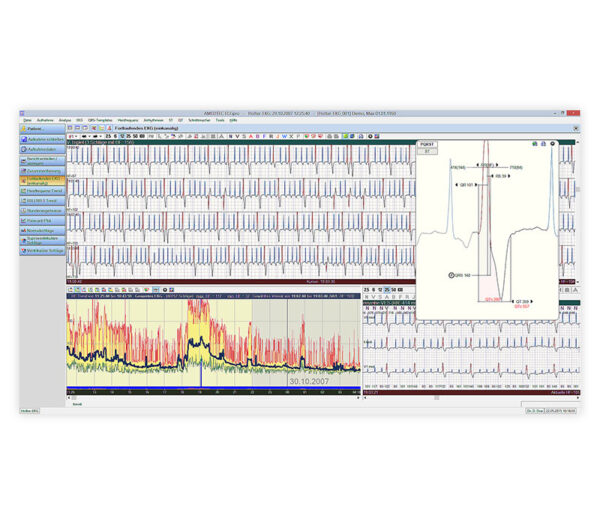 Amedtec EP830 Langzeit-EKG – Bildschirmansicht Fortlaufendes EKG mit HF-Trend und vergrößertem Einzelschlag