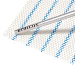 Ethicon Ultrapro Advanced Herniennetze – Detailansicht (Anwendungsbeispiel)