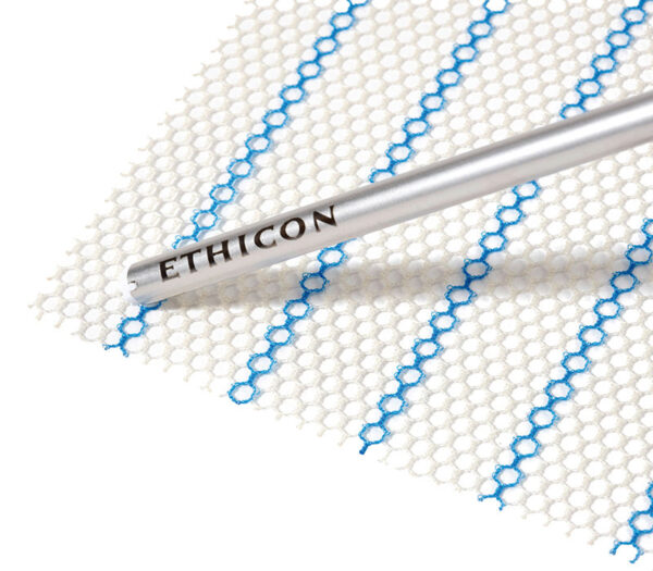 Ethicon Ultrapro Advanced Herniennetze – Detailansicht (Anwendungsbeispiel)