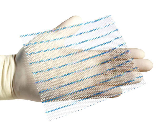 Ethicon Ultrapro Advanced Herniennetze (Anwendungsbeispiel)