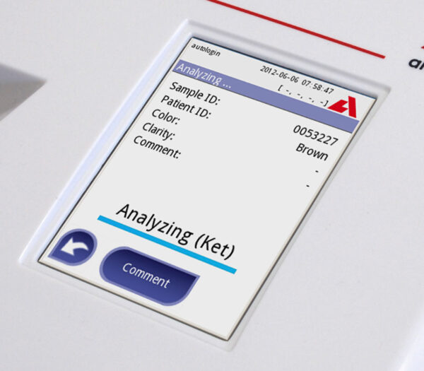 analyticon Urilyzer 100 Pro POCT-Analysegerät zur Urindiagnostik – Detailansicht Touchscreen