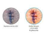 KaWe HiLight LED H-800 Kopfleuchte – Hoher Farbwiedergabeindex