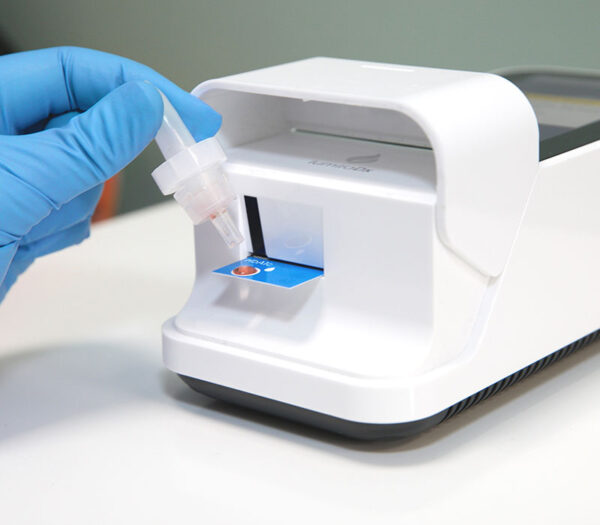 Roche LumiraDx Platform Multiparameter-Analysesystem (Anwendungsbeispiel)