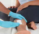 Essity / BSN Leukomed T plus Wundverband, Anwendungsbeispiel