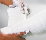 Lohmann & Rauscher Cellona Gipsbinden (Anwendungsbeispiel)
