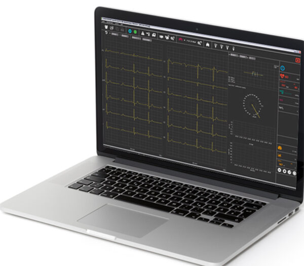 Dr. Gerhard Schmidt SmartScript 12-Kanal PC-Belastungs-EKG - Anwendungsbeispiel