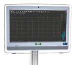 Dr. Gerhard Schmidt SmartScript 12-Kanal PC-Belastungs-EKG - Anwendungsbeispiel