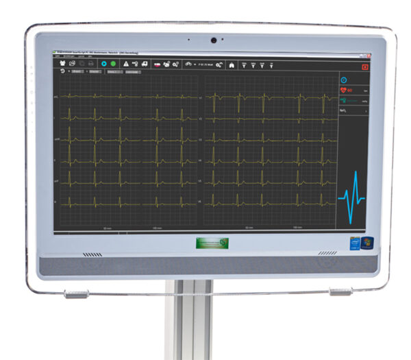 Dr. Gerhard Schmidt SmartScript 12-Kanal PC-Belastungs-EKG - Anwendungsbeispiel