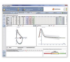 CareFusion Vyntus® Spiro PC-Spirometer – Softwareansicht Messergebnis