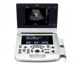 Edan Acclarix AX3 Mobiler Farbdoppler