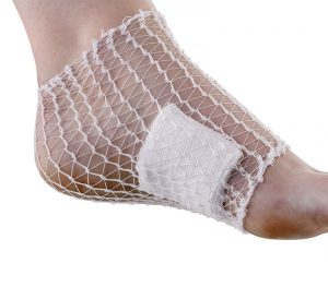 Trusetal Elastina® Netzschlauchverband (Anwendungsbeispiel)