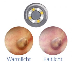 Luxamed LuxaScope Auris CCT LED 2,5V Otoskop mit Batteriegriff – LED-Ringe warmweiß/kaltweiß