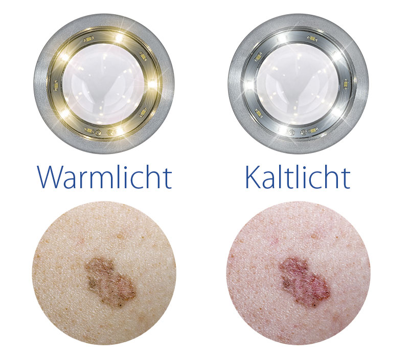 Luxamed LuxaScope CCT LED 2,5V Dermatoskop mit Batteriegriff – LED-Ringe warmweiß/kaltweiß Luxamed LuxaScope CCT LED 2,5V Dermatoskop mit Batteriegriff – LED-Ringe warmweiß/kaltweiß