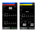Medical Econet Palmcare DUO Hand-Pulsoximeter mit EKG – Displayansichten