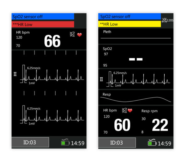Medical Econet Palmcare DUO Hand-Pulsoximeter mit EKG – Displayansichten