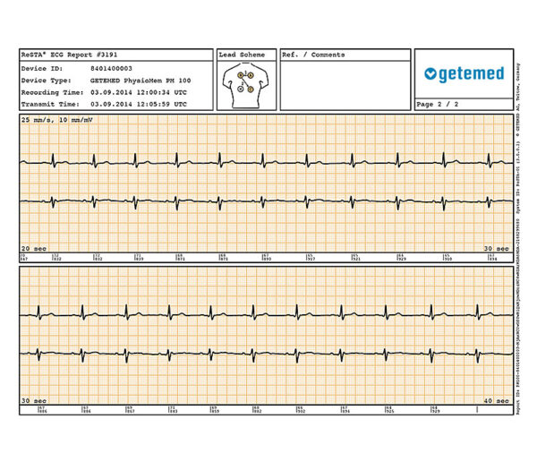 Getemed PhysioMem PM 100 4G mobiles Tele-EKG – EKG-Report