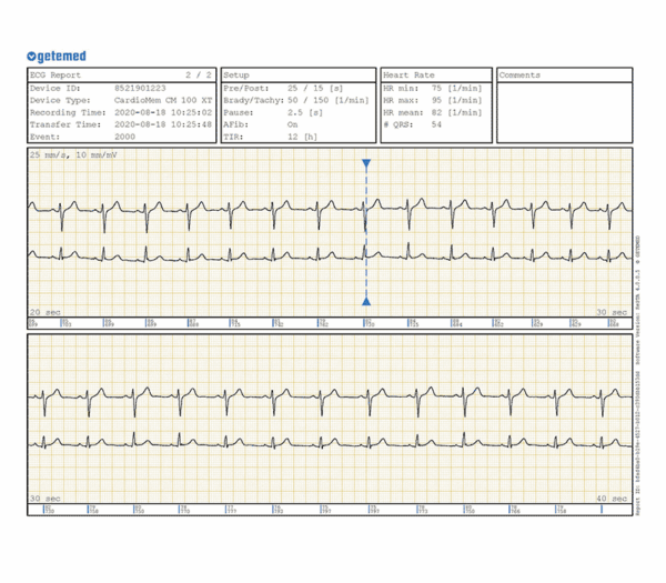 Getemed CardioMem CM 100 XT EKG-Loop-Rekorder PGA Kit – EKG-Report