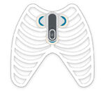 Getemed CardioMem CM 100 XT EKG-Loop-Rekorder PGA Kit – Positionierungsschema
