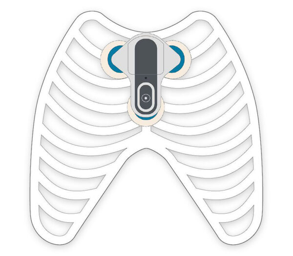 Getemed CardioMem CM 100 XT EKG-Loop-Rekorder PGA Kit – Positionierungsschema