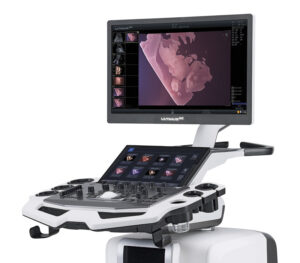 VINNO Ultimus 9E Farbdoppler-Ultraschallgerät mit KI-Integration – Detailansicht Monitor und Touchscreen