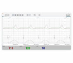 Medical Econet Smart 3 Zwilling-Fetalmonitor – Beispielansicht PC-Software