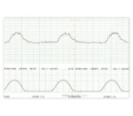 Medical Econet Smart 3 Zwilling-Fetalmonitor – Beispielansicht CTG-Ausschrieb