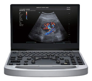 mindray MU7 Portables Farbdoppler-Ultraschallgerät