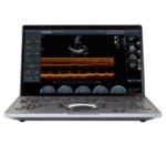 Chison SonoAir 20 portables Ultraschallgerät inkl. Trolley