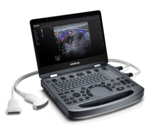 mindray MX3 Portables Farbdoppler-Ultraschallgerät