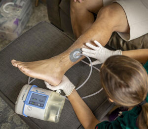 3M ActiV.A.C Unterdruck-Wundtherapie-System (Anwendungsbeispiel)