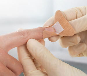 Essity / BSN Leukoplast Elastic Wundschnellverband – Fingerkuppenpflaster (Anwendungsbeispiel)