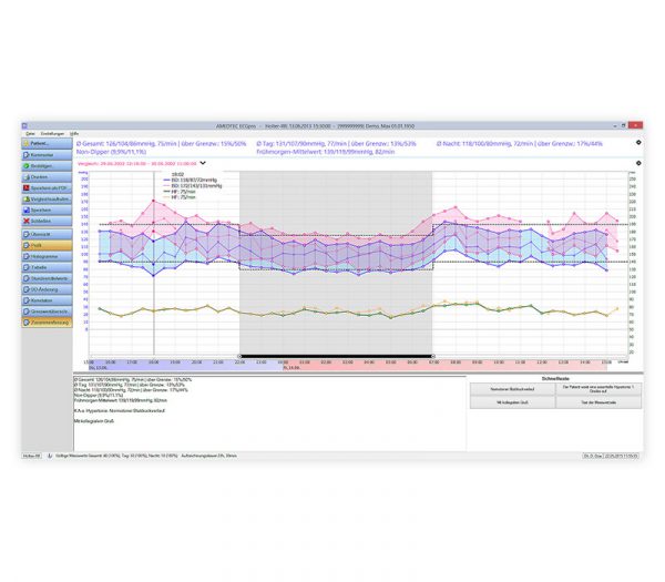 Amedtec Holter-RR Langzeit-Blutdruckmessgerät – Bildschirmansicht Messreihenvergleich