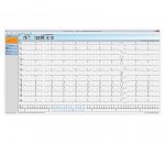 Amedtec CardioPart 12 PC-Ruhe-EKG – Bildschirmansicht EKG-Erfassung