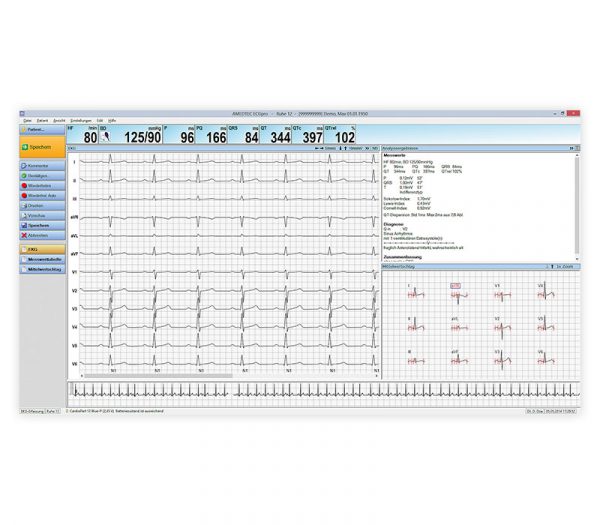 Amedtec CardioPart 12 PC-Ruhe-EKG – Bildschirmansicht Ergebnisse
