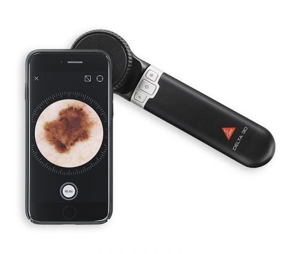 Heine DELTA 30 LED-Dermatoskop (Anwendungsbeispiel mit iPhone und Adapterschale)
