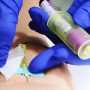 Stich-, Schnitt- und Kratzverletzung - Blutabnahme