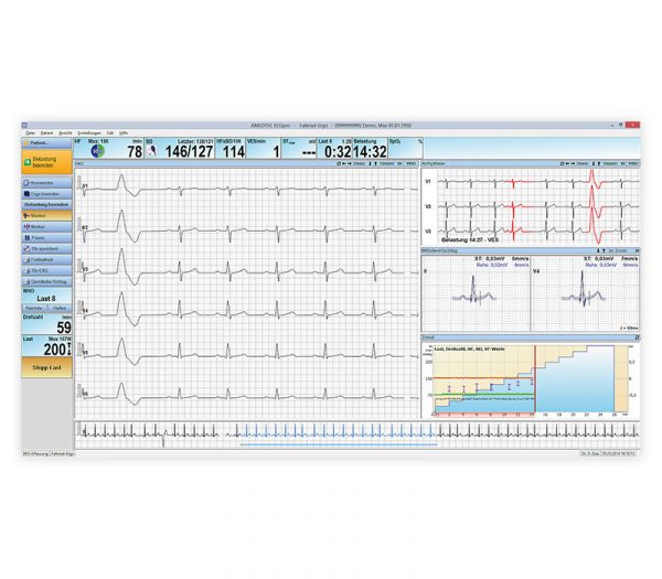 Amedtec CardioPart 12 PC-Belastungs-EKG – Bildschirmansicht Laufende Ergometrie mit Arrhythmieerkennung