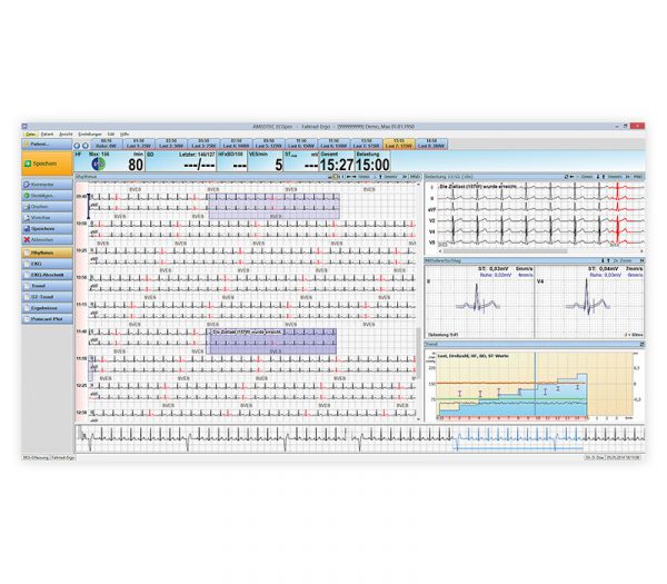 Amedtec CardioPart 12 PC-Belastungs-EKG – Bildschirmansicht Rhythmusübersicht
