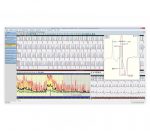 Amedtec EP8 Langzeit-EKG – Bildschirmansicht Fortlaufendes EKG mit HF-Trend und vergrößertem Einzelschlag