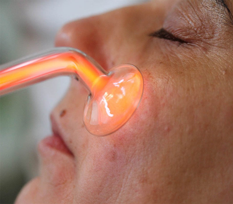 plasmaONE Kaltplasmatherapie-Gerät (Anwendungsbeispiel)