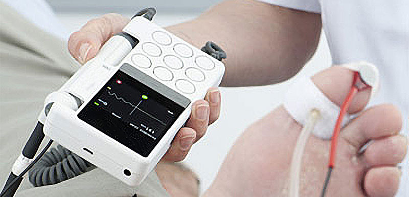 Zehendruckmessung mit dem Gefäßdoppler