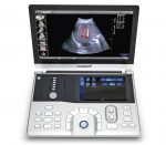 Vinno 6 Tragbares Farb­doppler-Ultra­schall­gerät