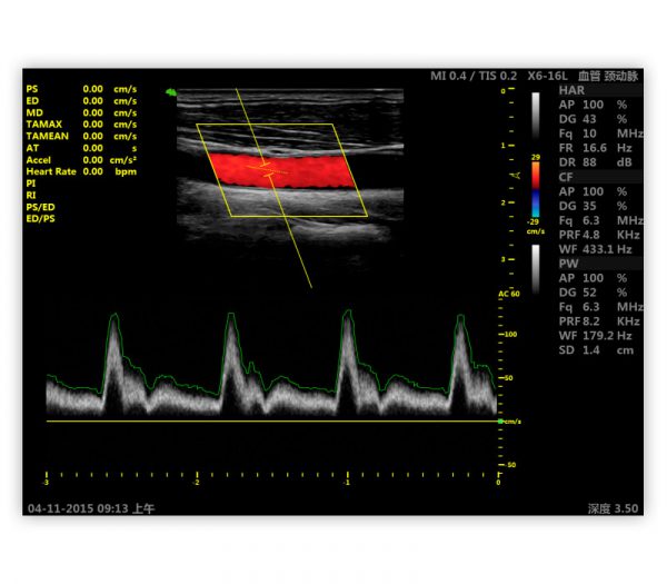 Vinno E10 Plus Farbdoppler-Ultraschallgerät – Bildschirmansicht